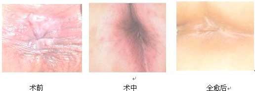 ΢